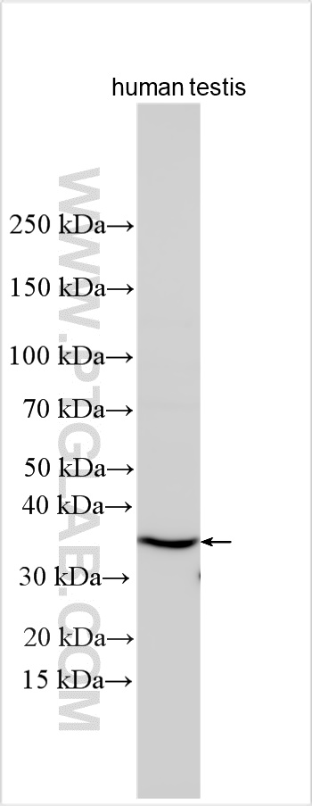 Western Blot (WB) analysis of various lysates using IL-20RB Polyclonal antibody (20521-1-AP)