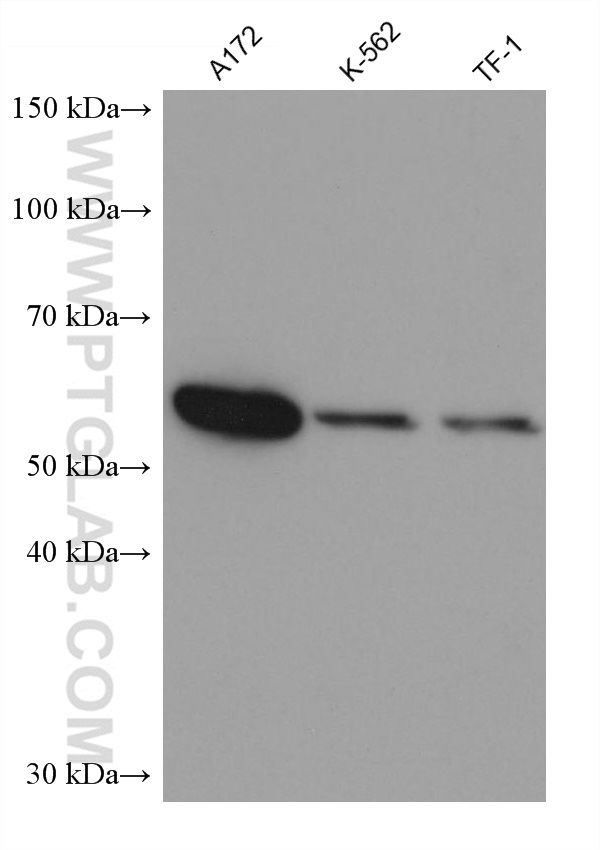 Western Blot (WB) analysis of various lysates using IL-21R Monoclonal antibody (66319-1-Ig)