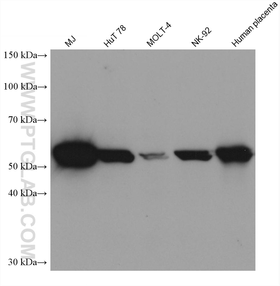 Western Blot (WB) analysis of various lysates using IL-21R Monoclonal antibody (66319-1-Ig)