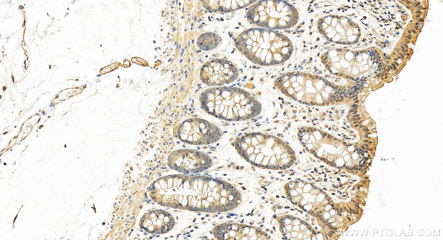 Immunohistochemistry (IHC) staining of human colon tissue using IL-24 Polyclonal antibody (26772-1-AP)