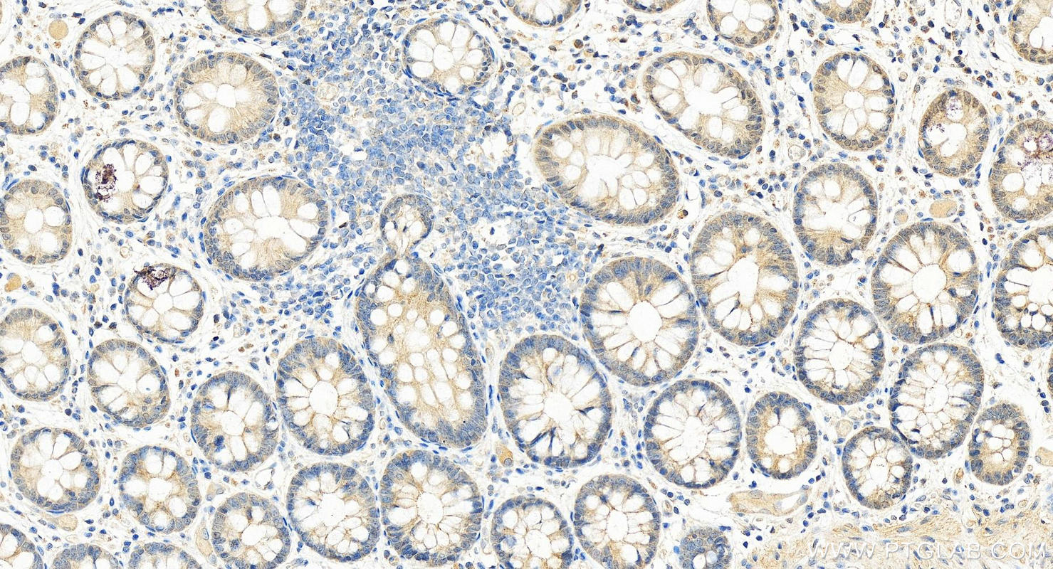 Immunohistochemistry (IHC) staining of human colon tissue using IL-24 Polyclonal antibody (26772-1-AP)