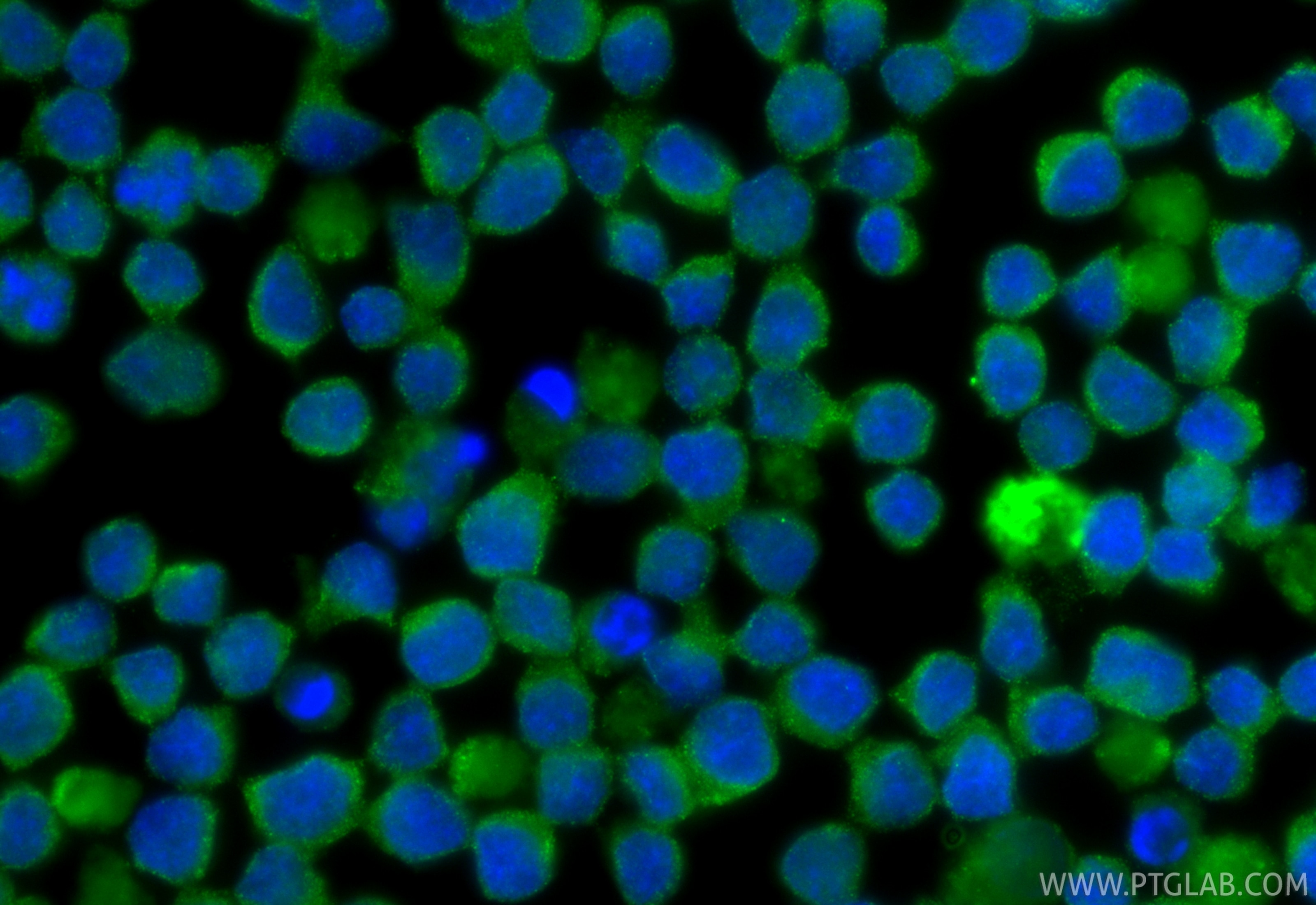 Immunofluorescence (IF) / fluorescent staining of Ramos cells using IL-4 Monoclonal antibody (66142-1-Ig)