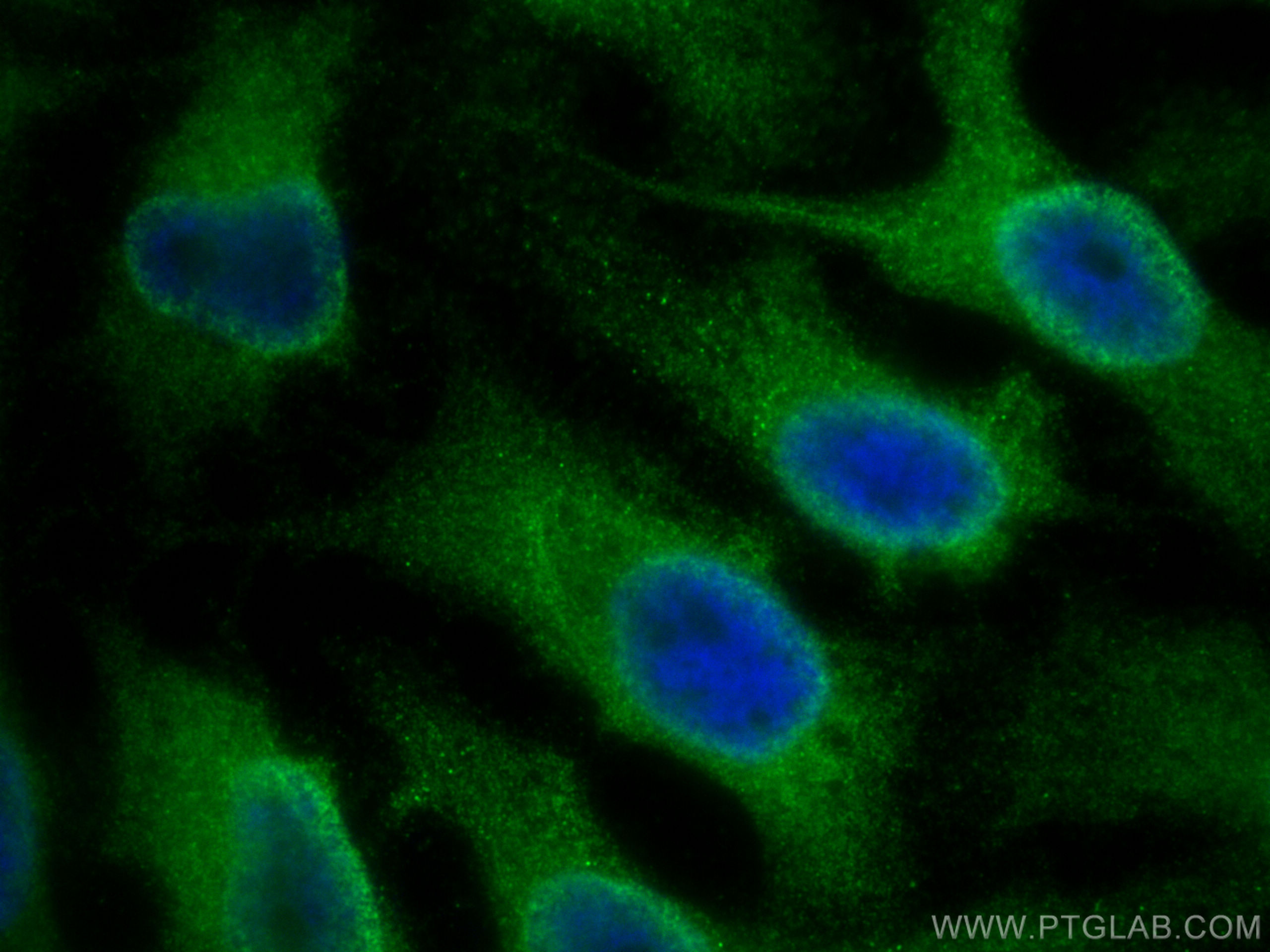 Immunofluorescence (IF) / fluorescent staining of HeLa cells using IL-4I1 Polyclonal antibody (23048-1-AP)