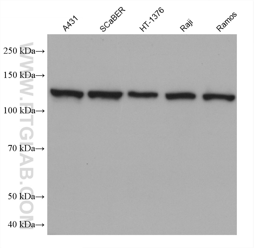 Western Blot (WB) analysis of various lysates using IL-4R Monoclonal antibody (67051-1-Ig)