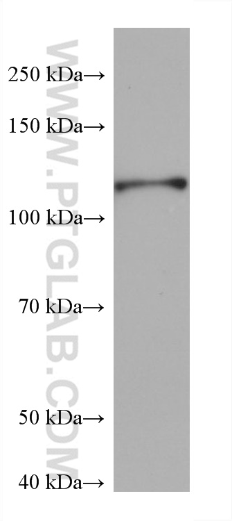 Western Blot (WB) analysis of MG-63 cells using IL-4R Monoclonal antibody (67051-1-Ig)