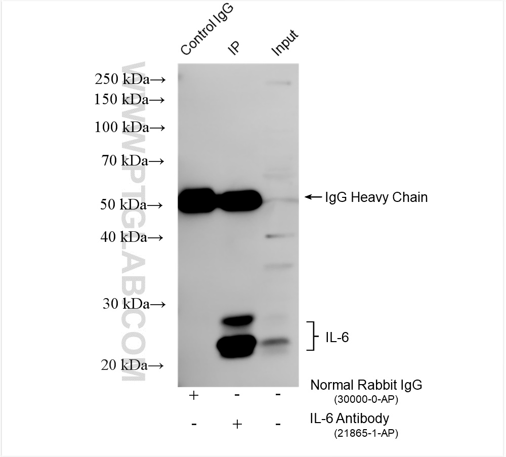 Immunoprecipitation (IP) experiment of HUVEC cells using IL-6 Polyclonal antibody (21865-1-AP)