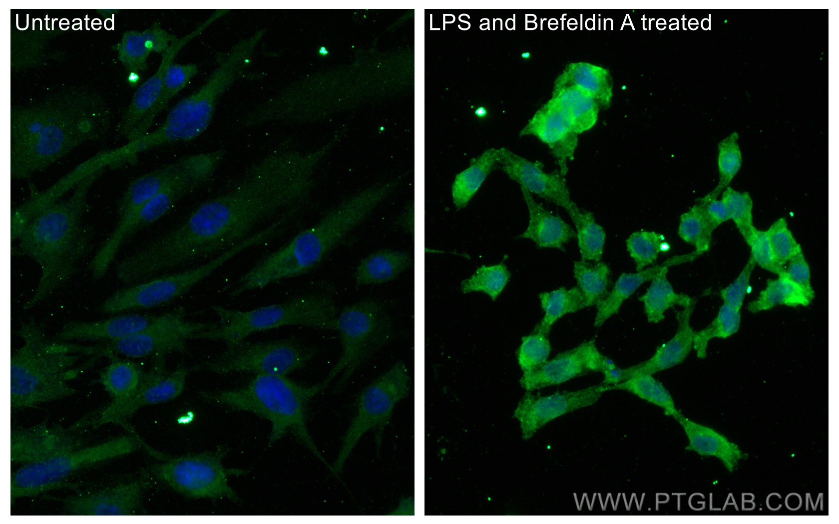 Immunofluorescence (IF) / fluorescent staining of HUVEC cells using IL-6 Monoclonal antibody (66146-1-Ig)