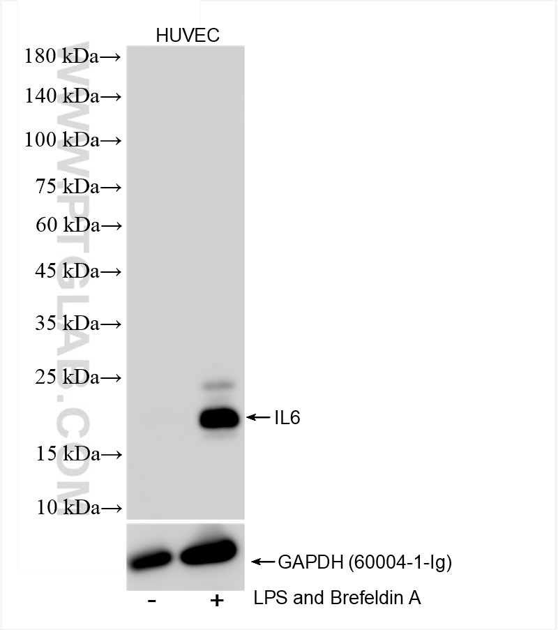 Western Blot (WB) analysis of HUVEC cells using IL-6 Recombinant antibody (83747-7-RR)