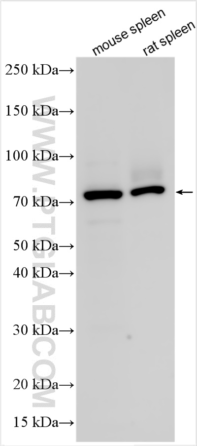 Western Blot (WB) analysis of various lysates using CD126/IL-6R alpha Polyclonal antibody (23457-1-AP)