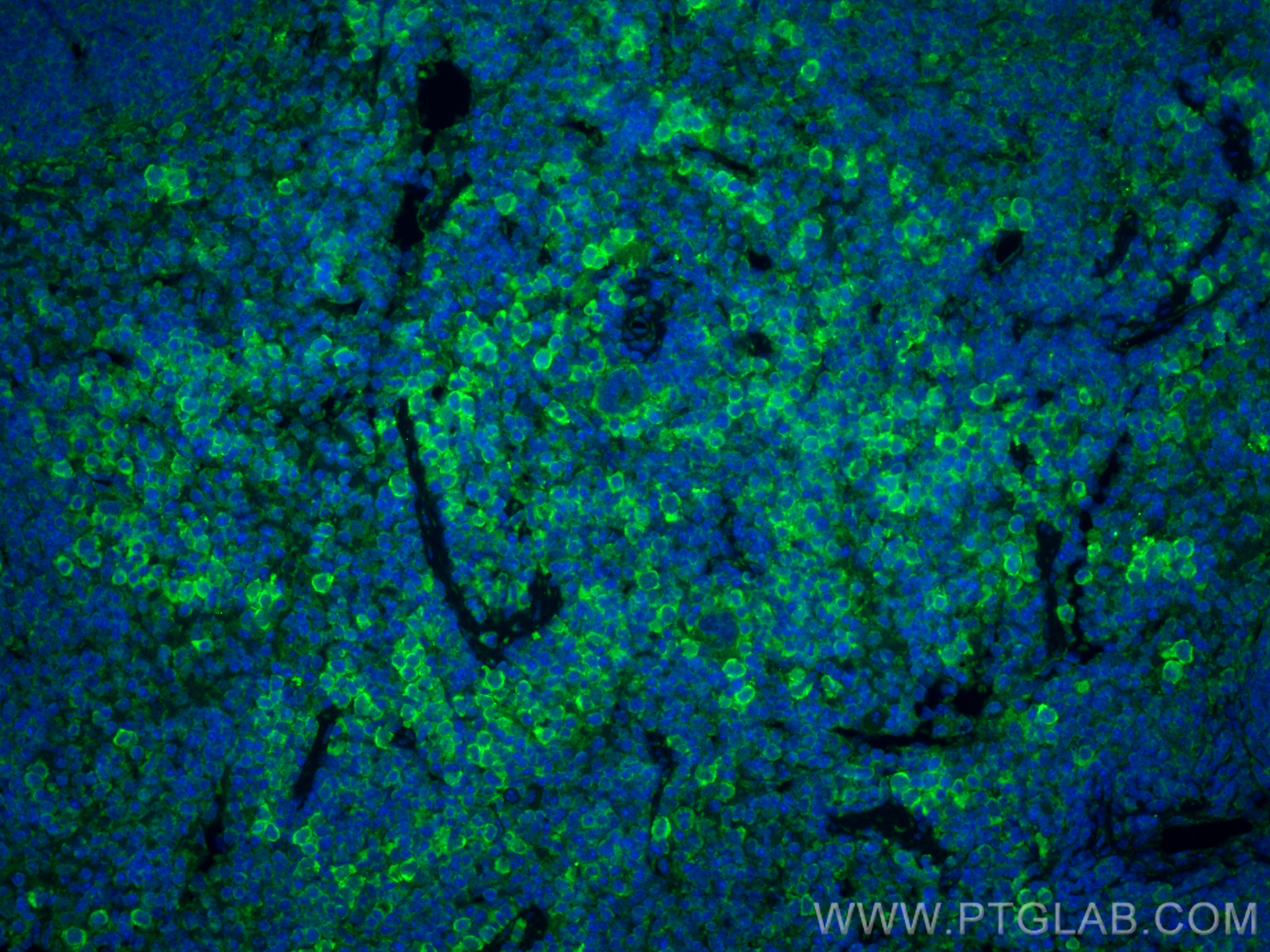 Immunofluorescence (IF) / fluorescent staining of mouse spleen tissue using IL-7Ra/CD127 Polyclonal antibody (17626-1-AP)