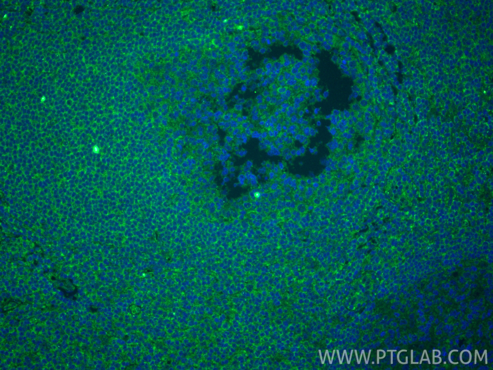 Immunofluorescence (IF) / fluorescent staining of human tonsillitis tissue using IL-9 Monoclonal antibody (66144-1-Ig)