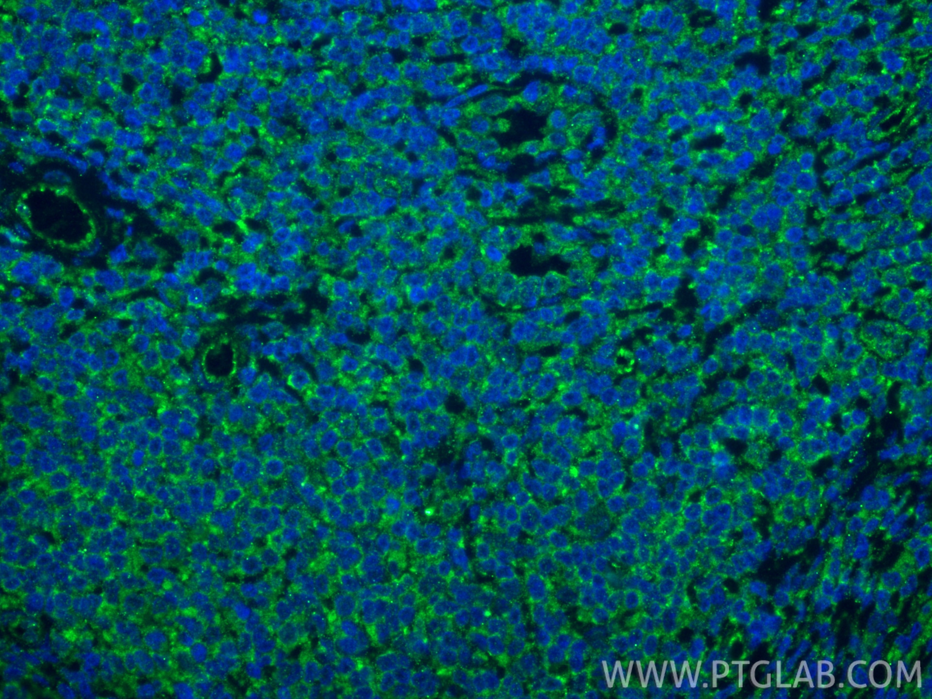 Immunofluorescence (IF) / fluorescent staining of human tonsillitis tissue using IL-9 Monoclonal antibody (66144-1-Ig)