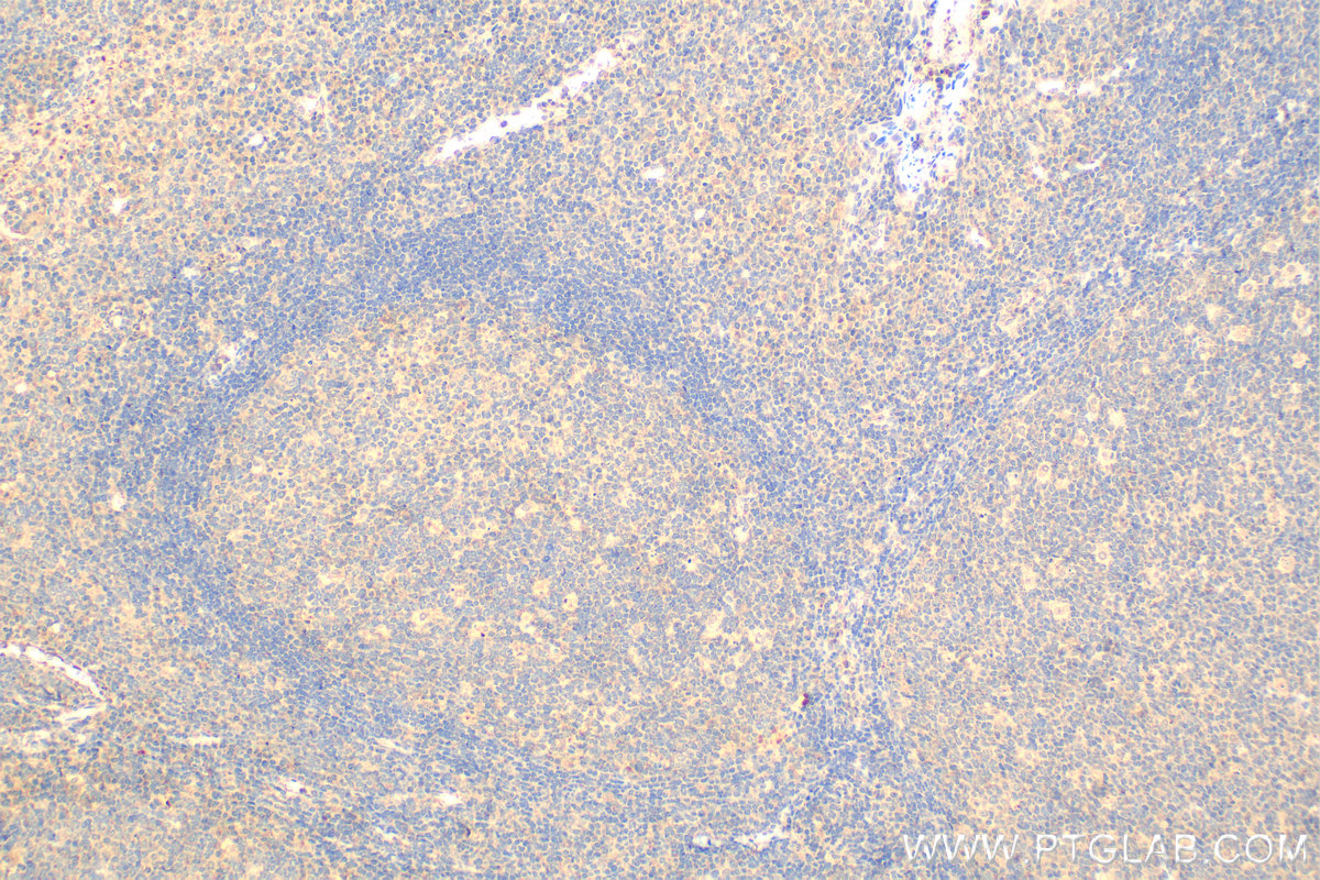 Immunohistochemistry (IHC) staining of human tonsillitis tissue using IL-9 Monoclonal antibody (66144-1-Ig)