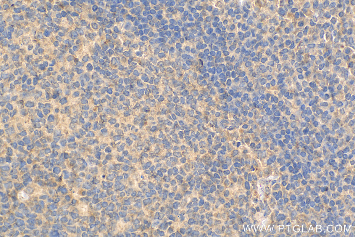 Immunohistochemistry (IHC) staining of human tonsillitis tissue using IL-9 Monoclonal antibody (66144-1-Ig)