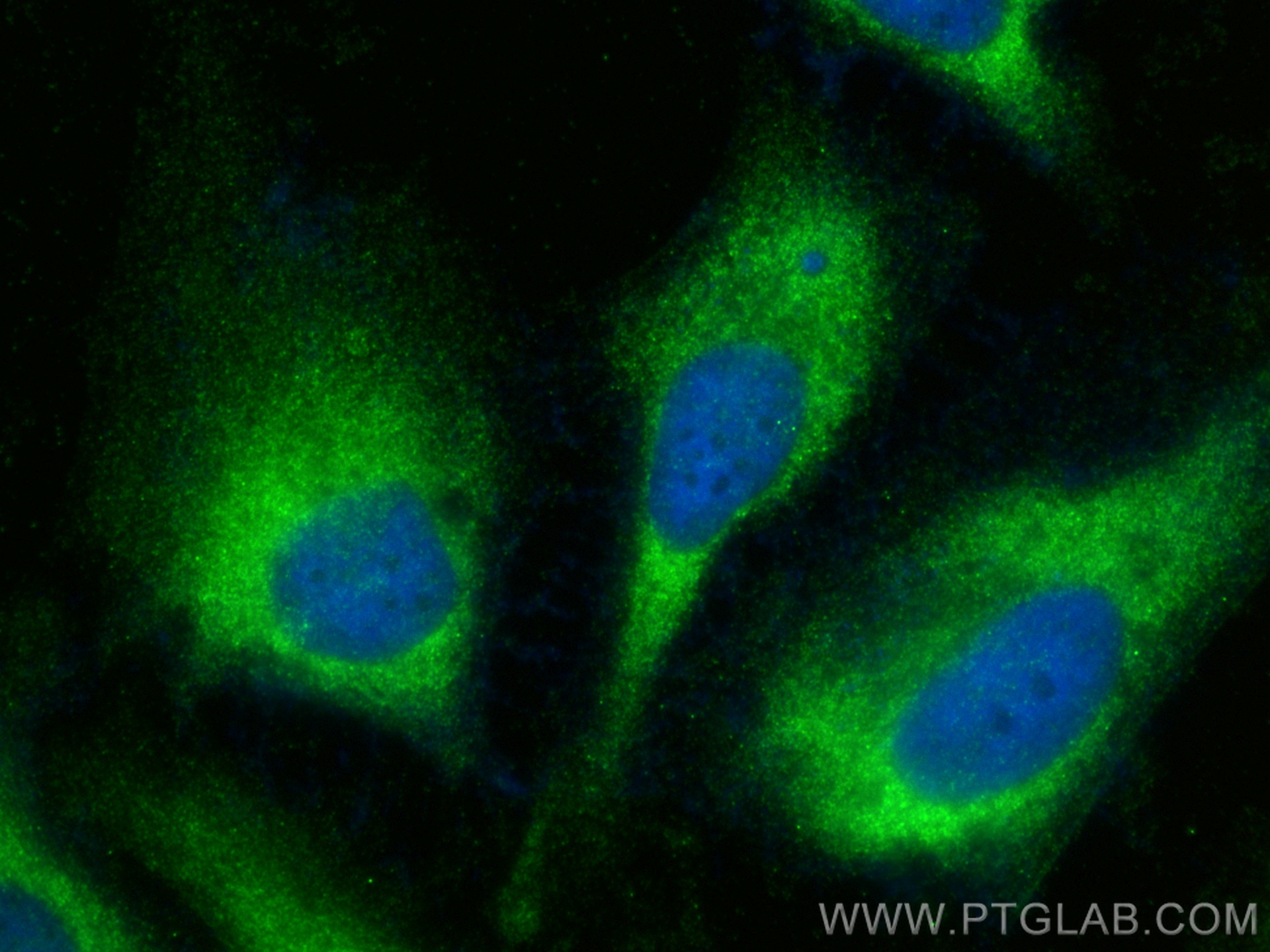 Immunofluorescence (IF) / fluorescent staining of HeLa cells using ILVBL Polyclonal antibody (11220-1-AP)