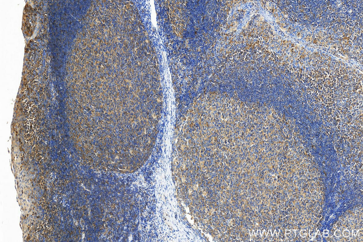 Immunohistochemistry (IHC) staining of human tonsillitis tissue using IMPDH1 Polyclonal antibody (22092-1-AP)