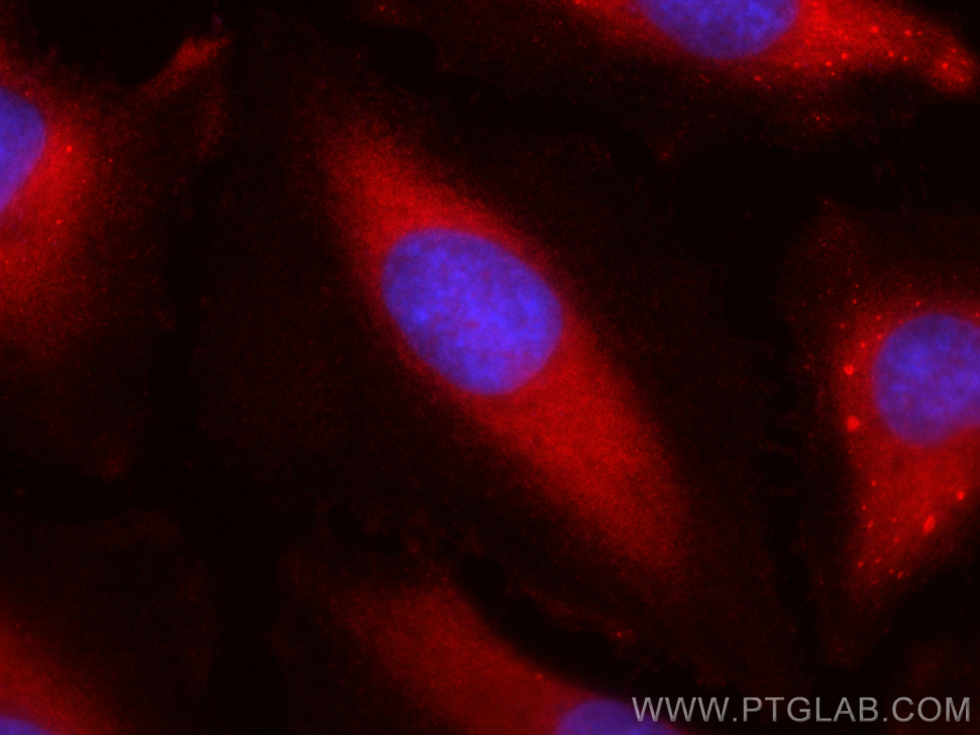 Immunofluorescence (IF) / fluorescent staining of HeLa cells using CoraLite®594-conjugated IMPDH2 Polyclonal antibody (CL594-12948)