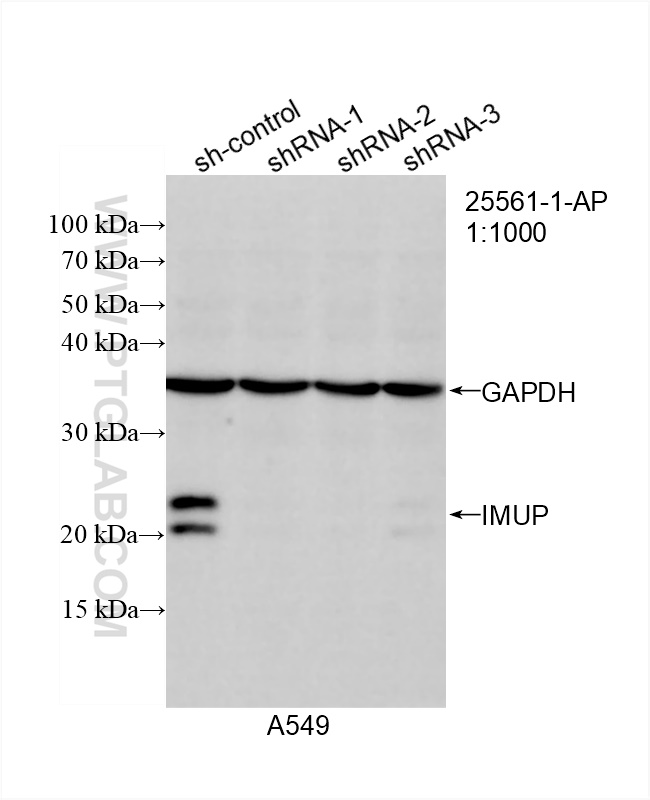 Western Blot (WB) analysis of A549 cells using IMUP Polyclonal antibody (25561-1-AP)