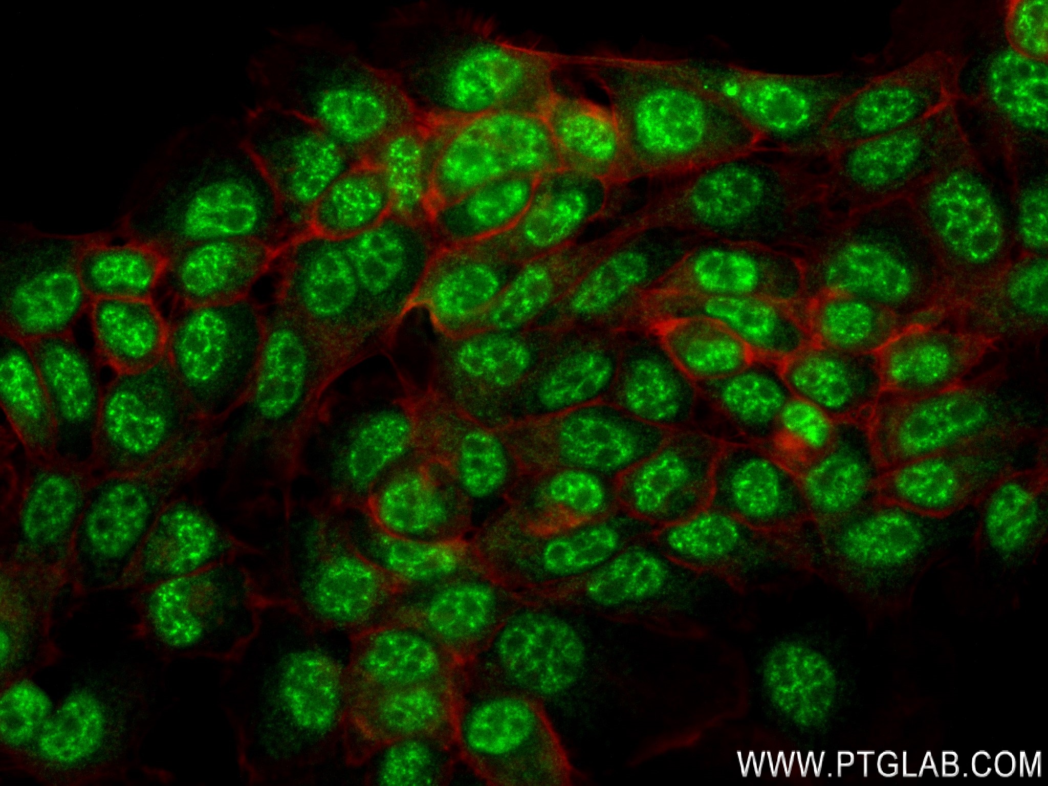 Immunofluorescence (IF) / fluorescent staining of A431 cells using IMUP Recombinant antibody (84148-6-RR)