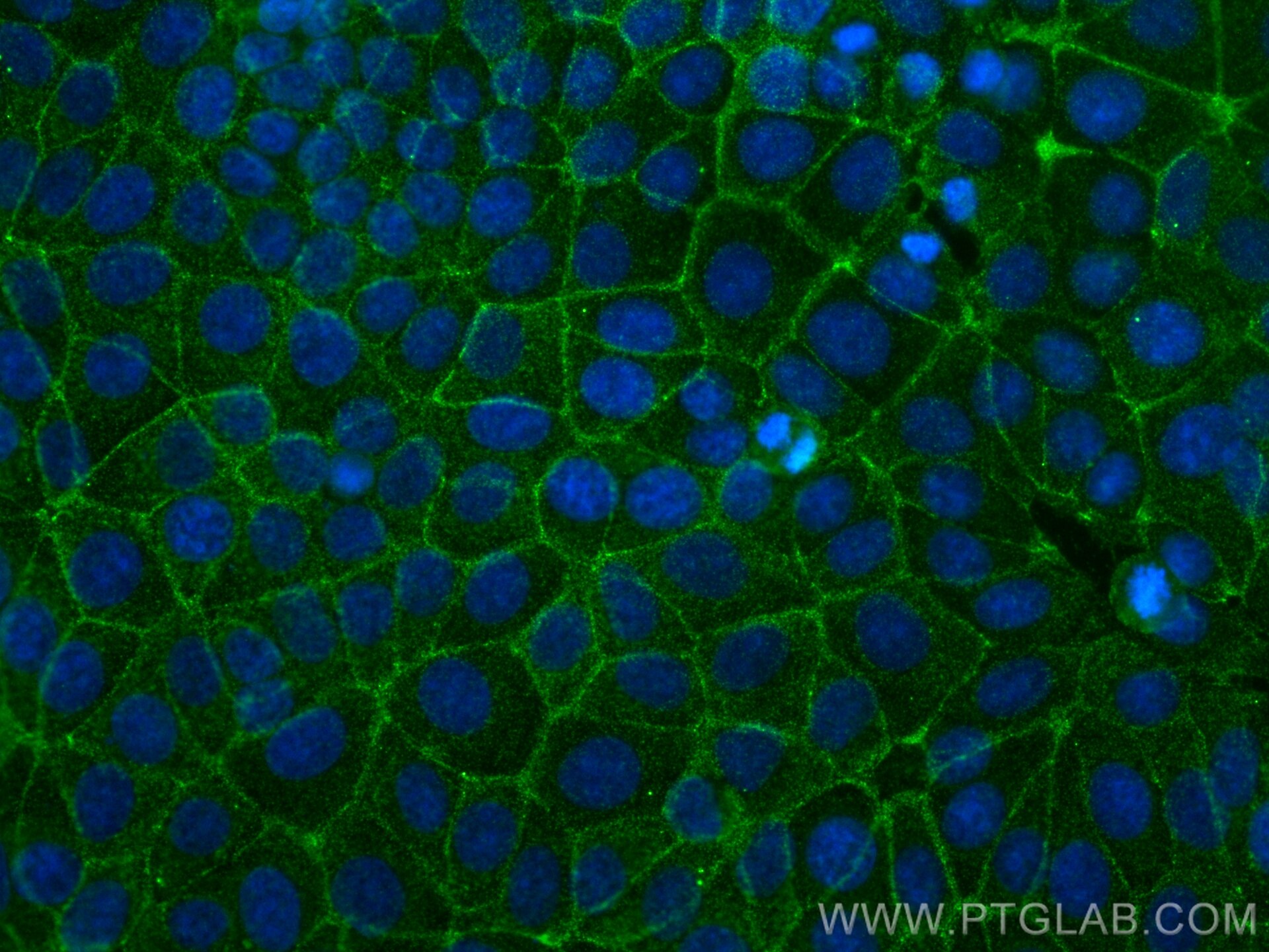Immunofluorescence (IF) / fluorescent staining of MCF-7 cells using INADL Monoclonal antibody (67833-1-Ig)