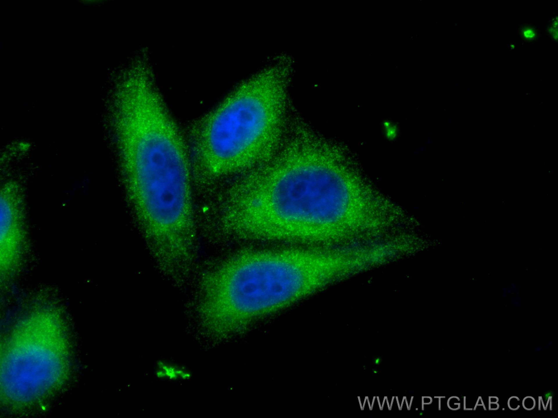 Immunofluorescence (IF) / fluorescent staining of HepG2 cells using INF2 Polyclonal antibody (20466-1-AP)