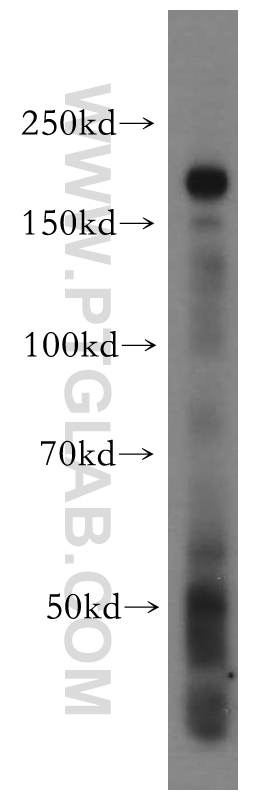 Western Blot (WB) analysis of HeLa cells using INF2 Polyclonal antibody (20466-1-AP)