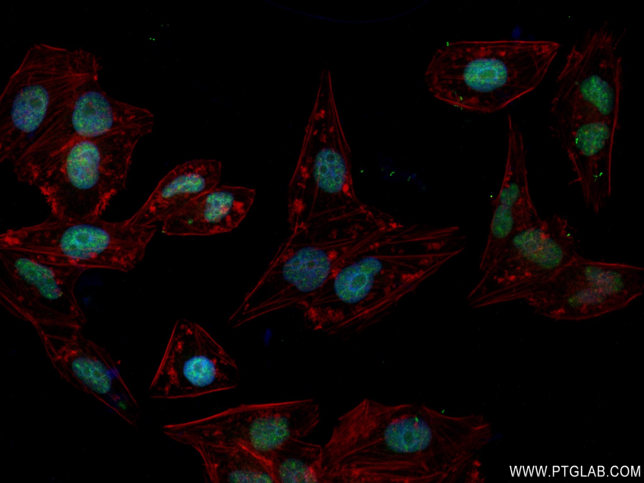 Immunofluorescence (IF) / fluorescent staining of HepG2 cells using INO80 Recombinant antibody (83117-4-RR)