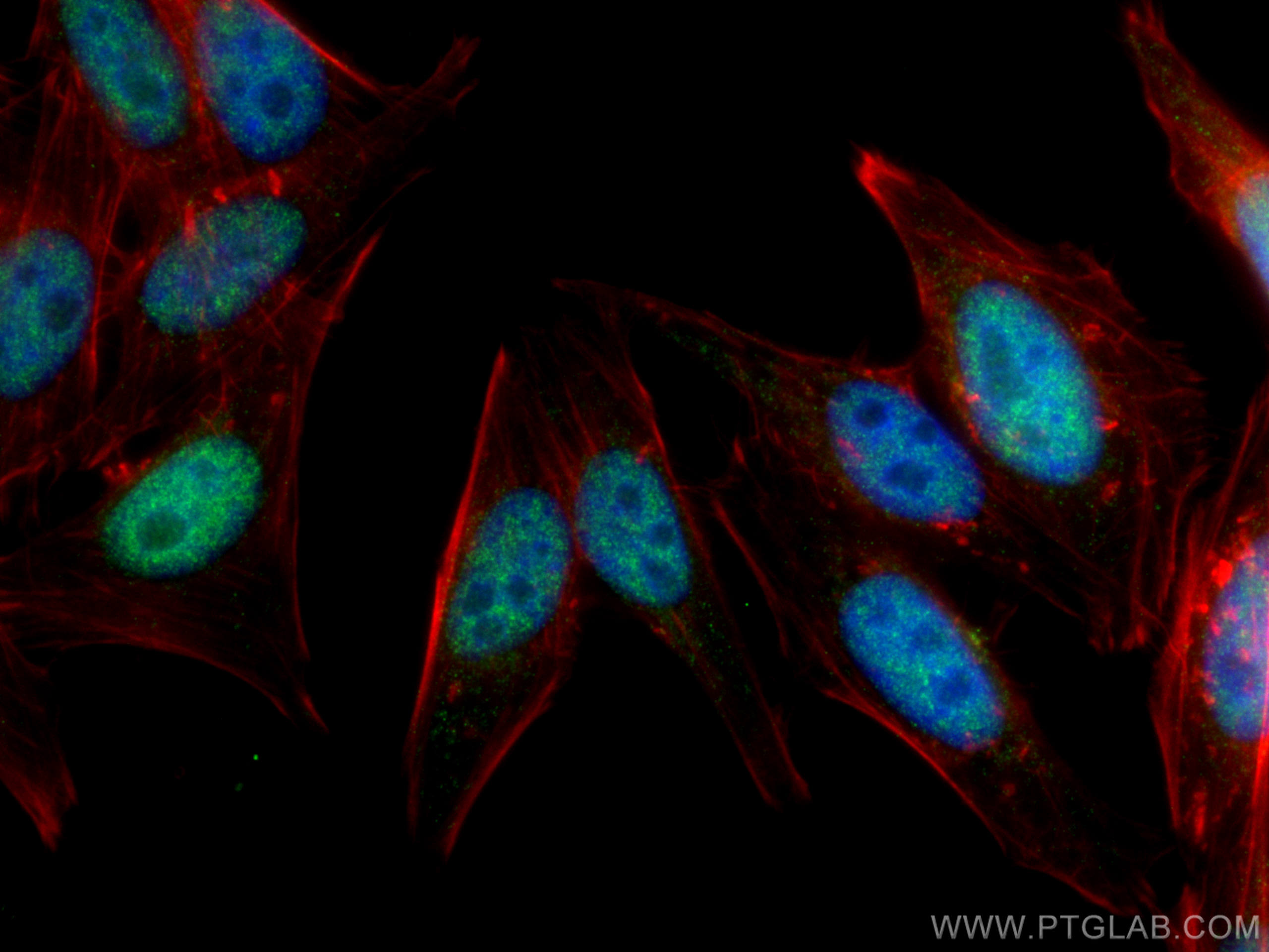 Immunofluorescence (IF) / fluorescent staining of HepG2 cells using INO80B Polyclonal antibody (29488-1-AP)