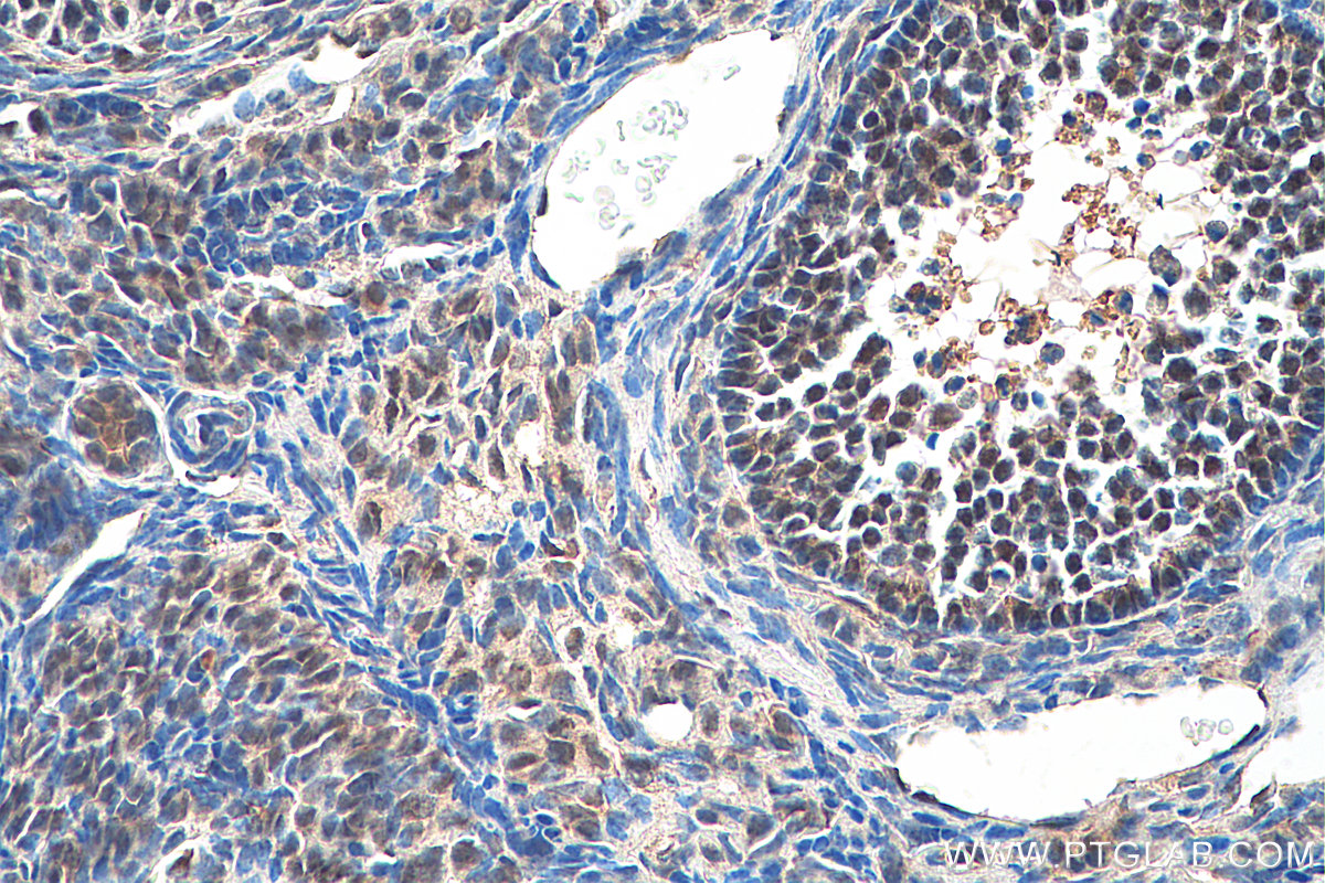 Immunohistochemistry (IHC) staining of mouse ovary tissue using INO80B Polyclonal antibody (29488-1-AP)