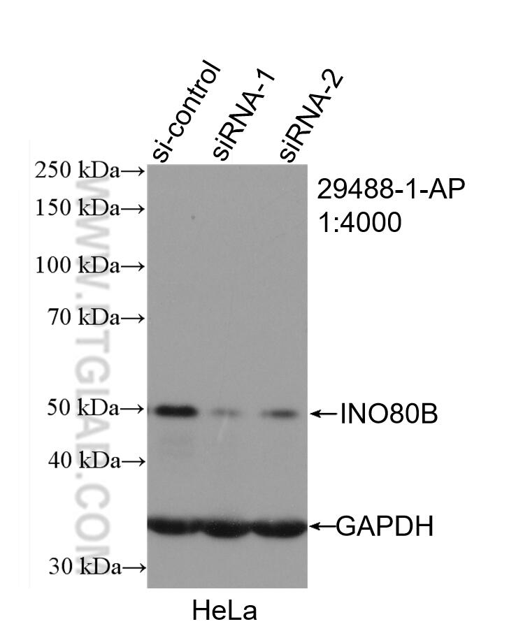 Western Blot (WB) analysis of HeLa cells using INO80B Polyclonal antibody (29488-1-AP)