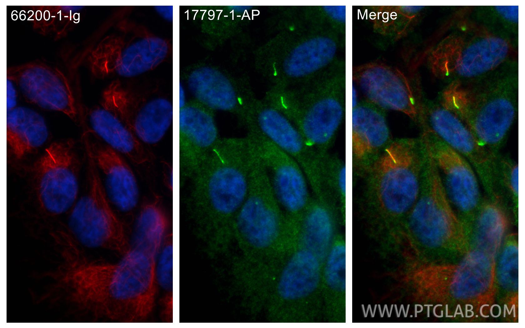 Immunofluorescence (IF) / fluorescent staining of hTERT-RPE1 cells using INPP5E Polyclonal antibody (17797-1-AP)
