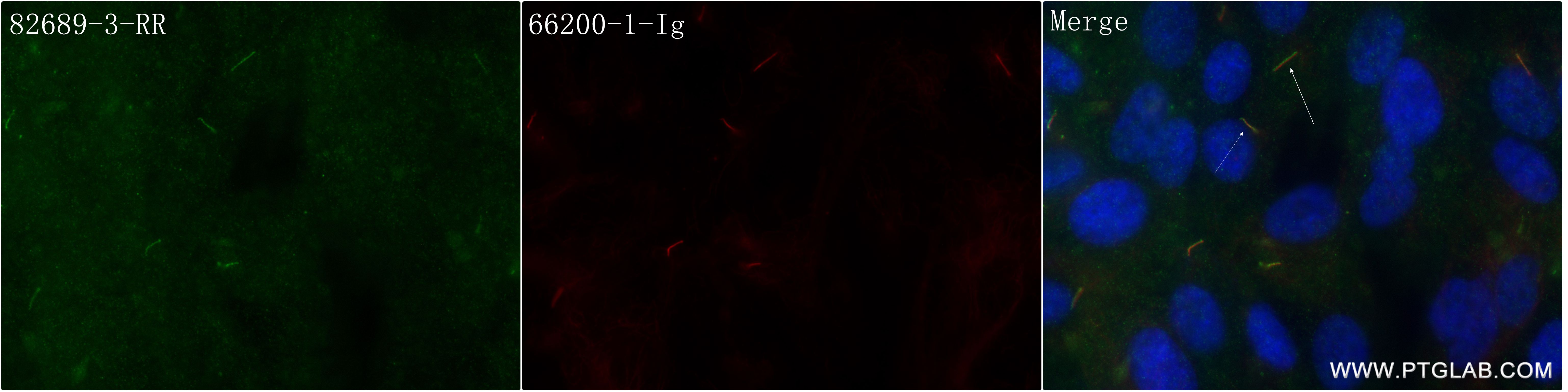 Immunofluorescence (IF) / fluorescent staining of hTERT-RPE1 cells using INPP5E Recombinant antibody (82689-3-RR)