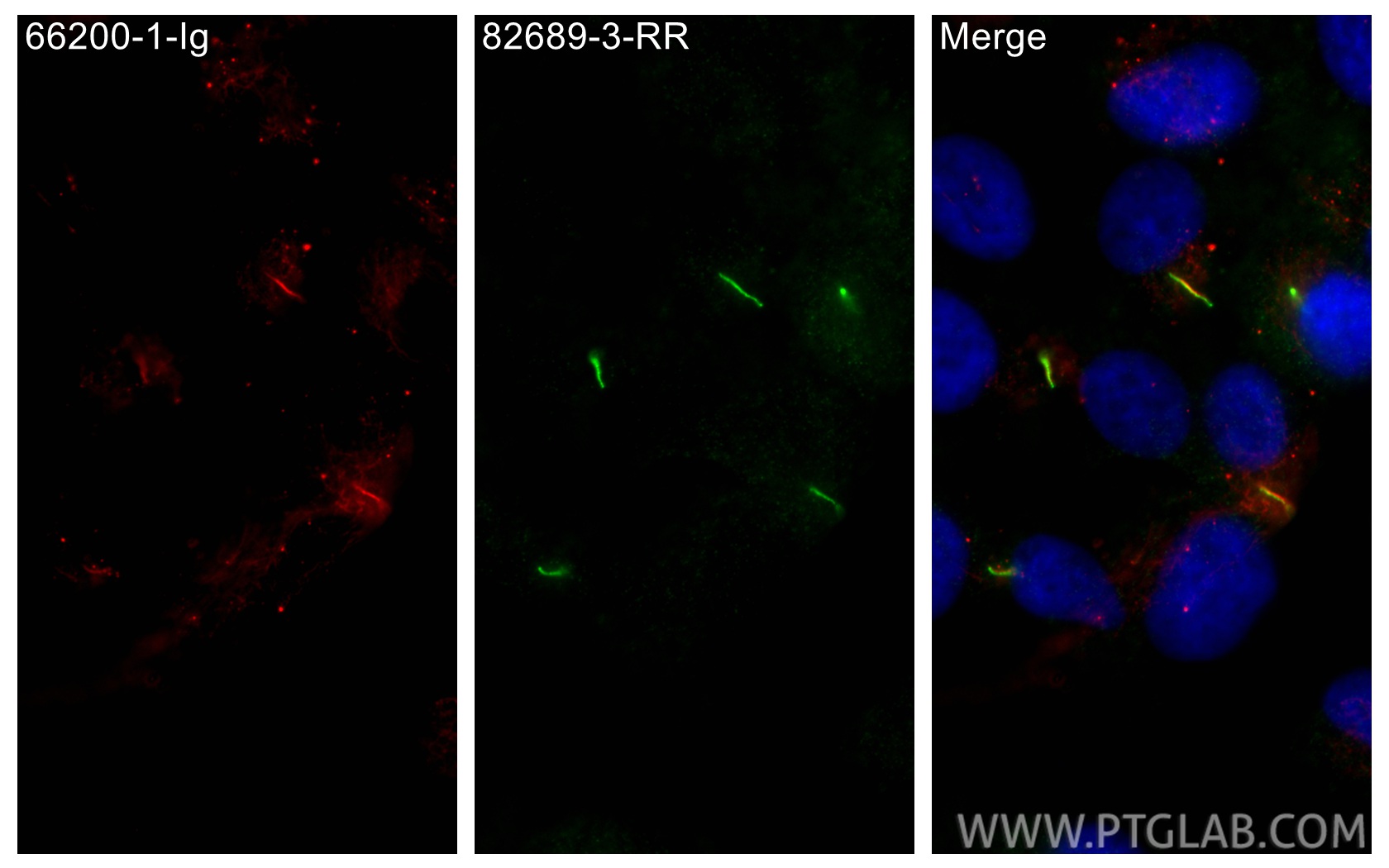 Immunofluorescence (IF) / fluorescent staining of hTERT-RPE1 cells using INPP5E Recombinant monoclonal antibody (82689-3-RR)