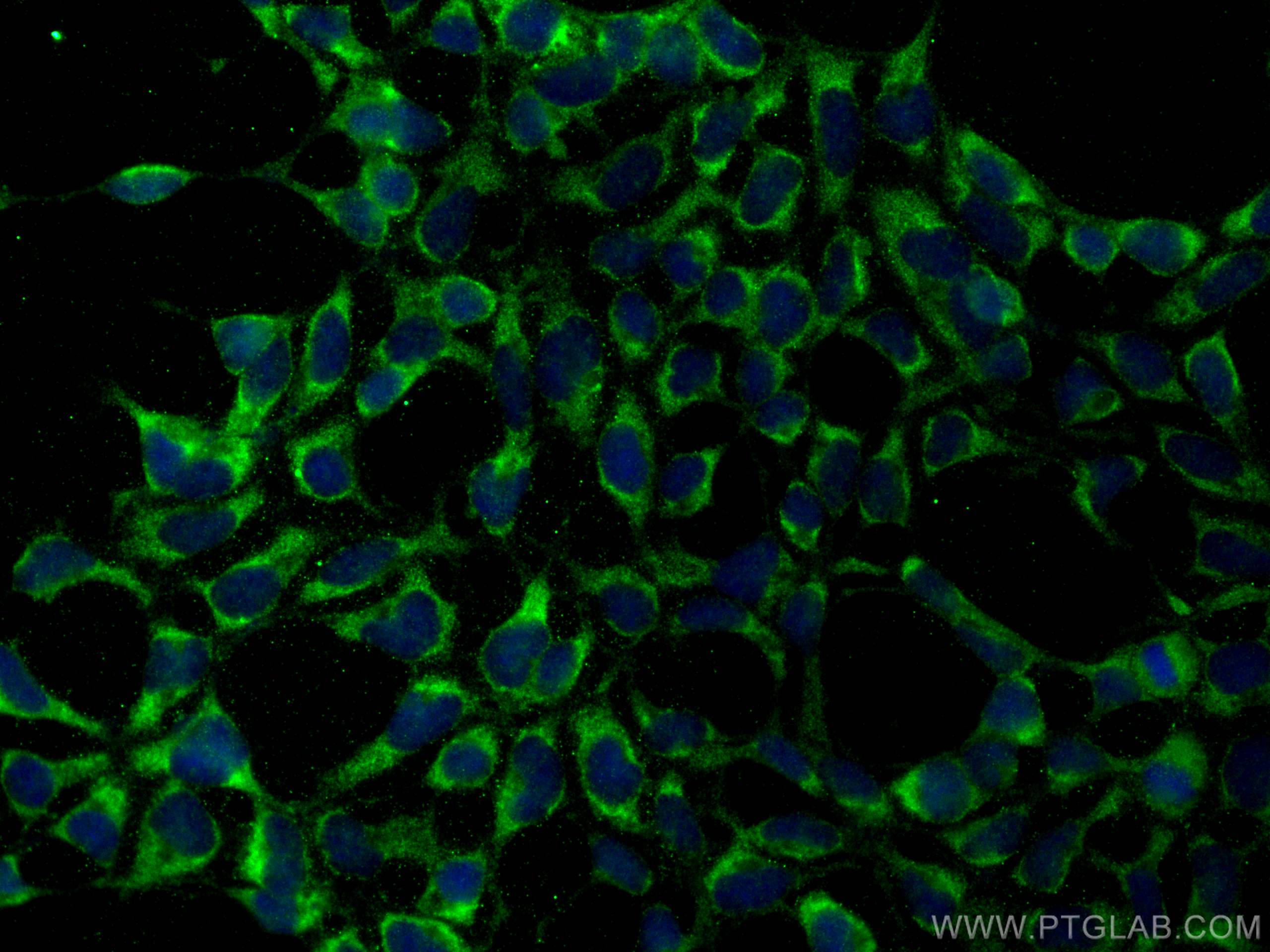 Immunofluorescence (IF) / fluorescent staining of HEK-293 cells using INSIG1 Polyclonal antibody (55282-1-AP)