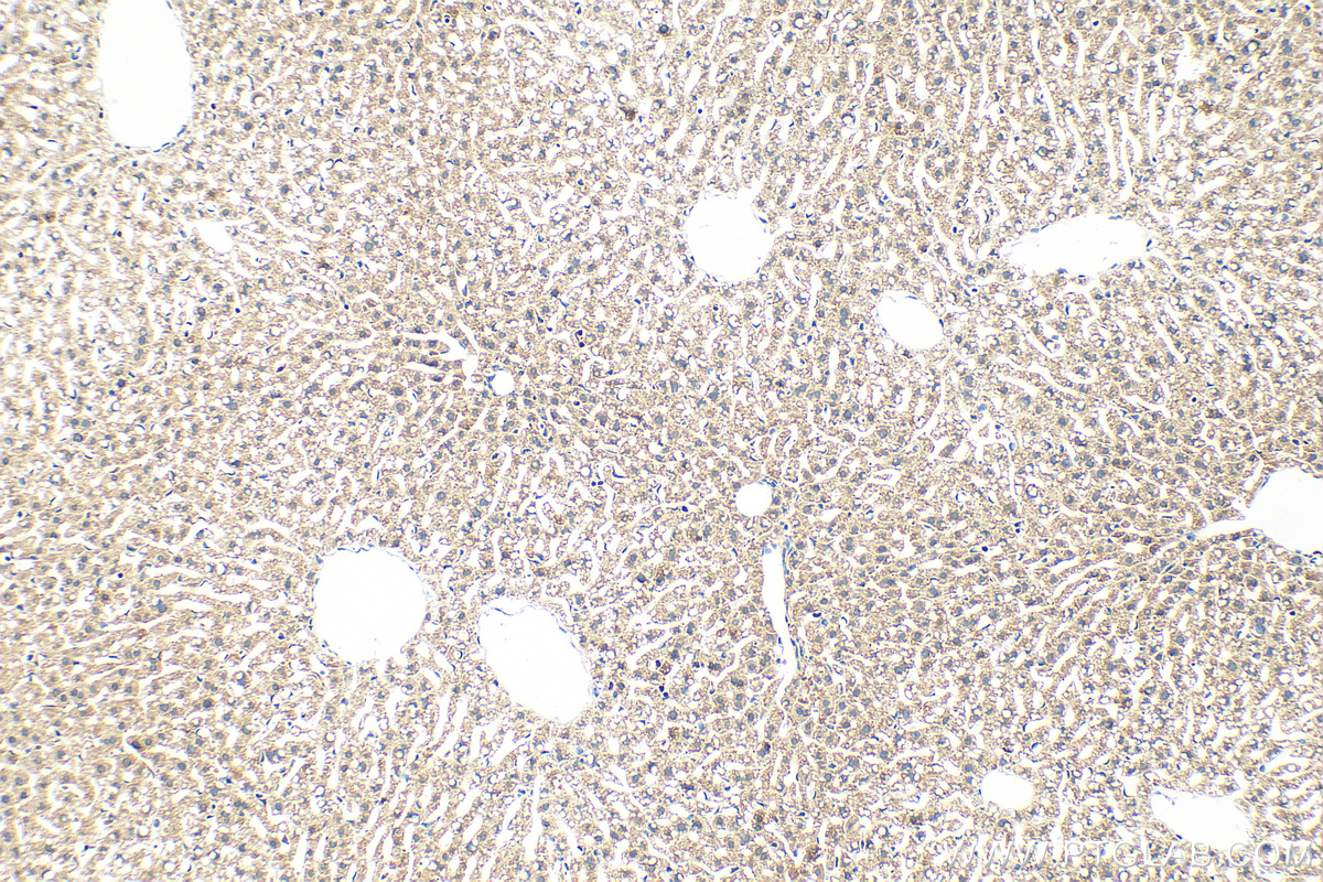 Immunohistochemistry (IHC) staining of mouse liver tissue using INSIG1 Polyclonal antibody (55282-1-AP)