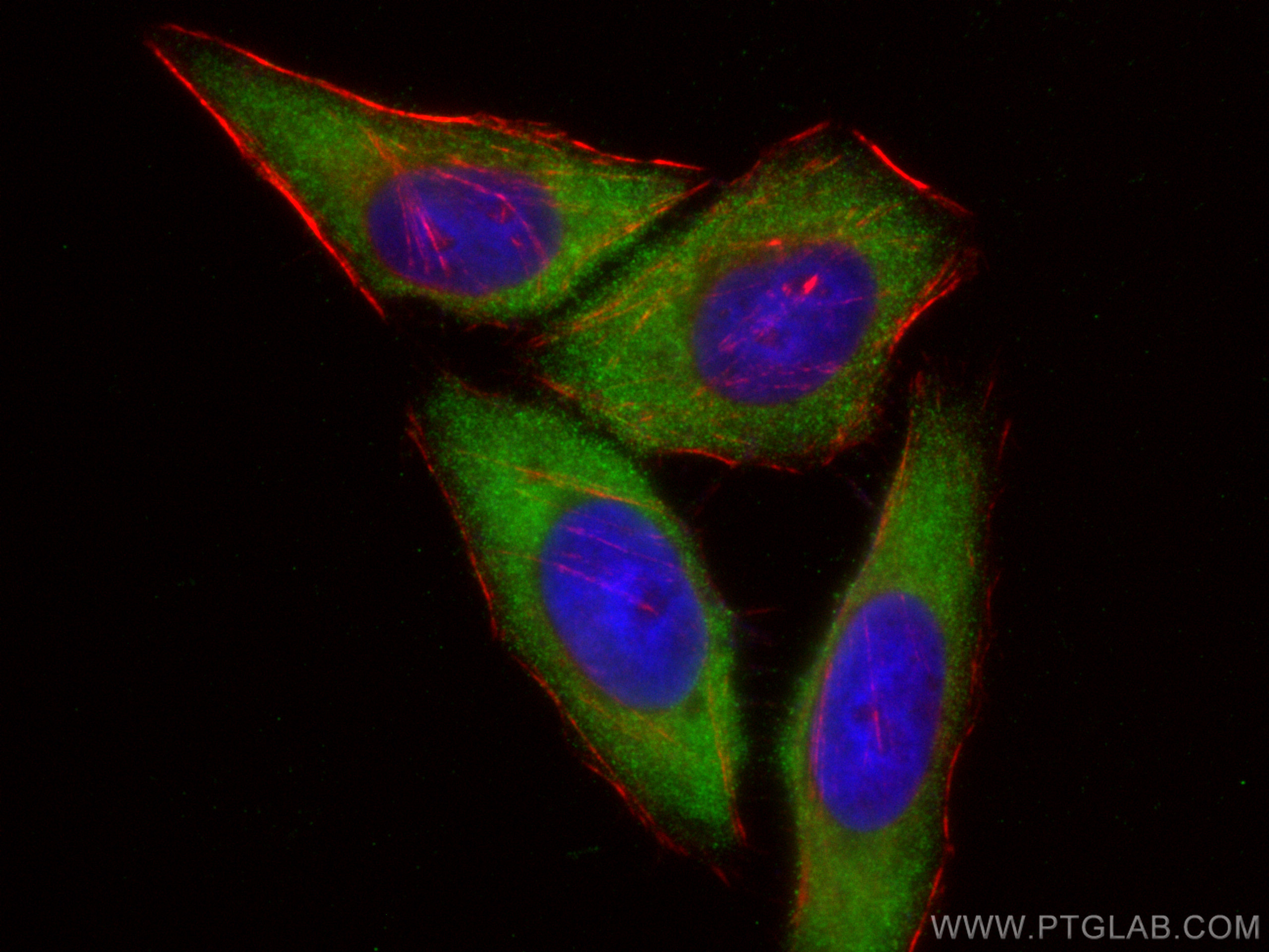 Immunofluorescence (IF) / fluorescent staining of HepG2 cells using INSIG2 Polyclonal antibody (24766-1-AP)