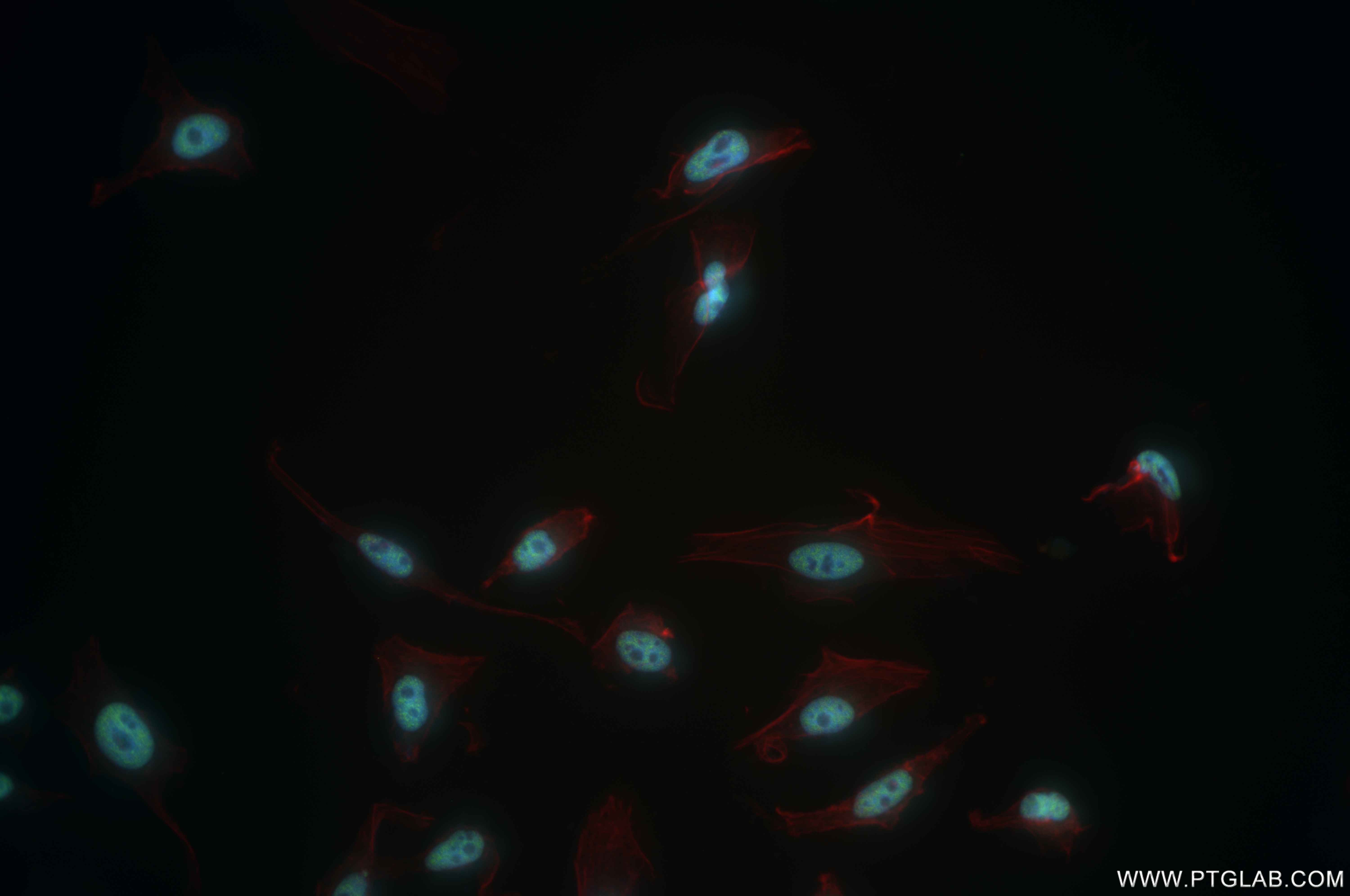 Immunofluorescence (IF) / fluorescent staining of HeLa cells using INTS6 Recombinant antibody (84610-3-RR)