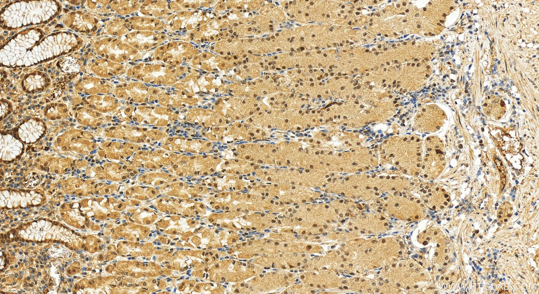 Immunohistochemistry (IHC) staining of human stomach tissue using INTS9 Polyclonal antibody (11657-1-AP)