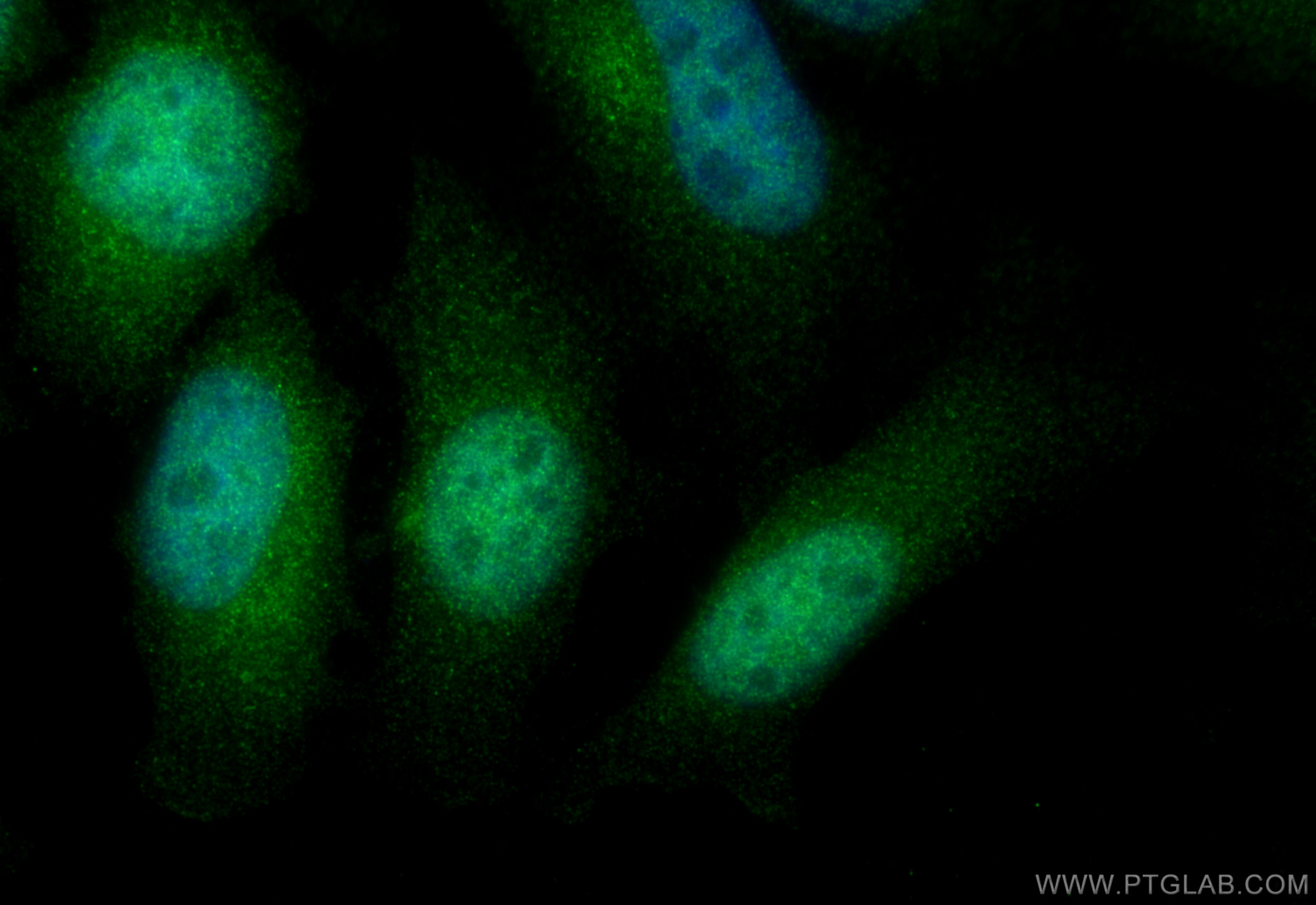 Immunofluorescence (IF) / fluorescent staining of HeLa cells using IPO11 Polyclonal antibody (14403-1-AP)