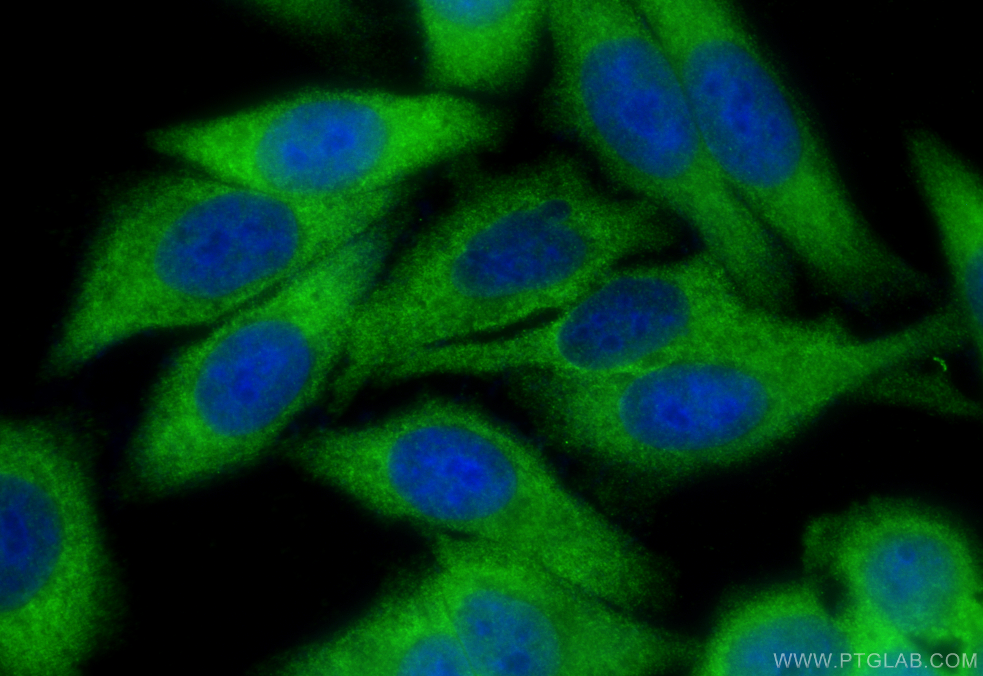 Immunofluorescence (IF) / fluorescent staining of HepG2 cells using IPO4 Polyclonal antibody (11679-1-AP)