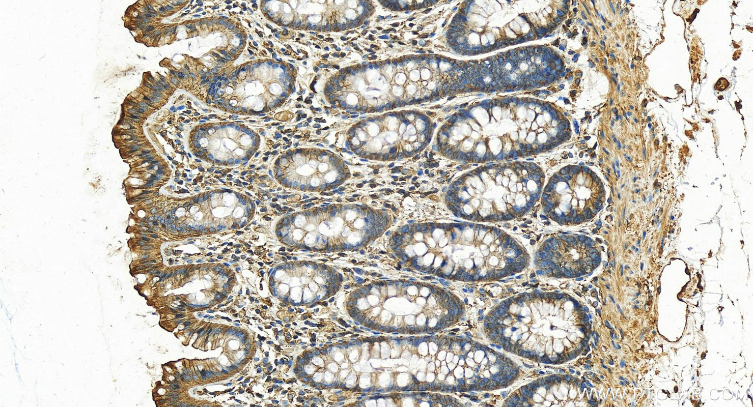 Immunohistochemistry (IHC) staining of human colon tissue using IQGAP1 Polyclonal antibody (22167-1-AP)