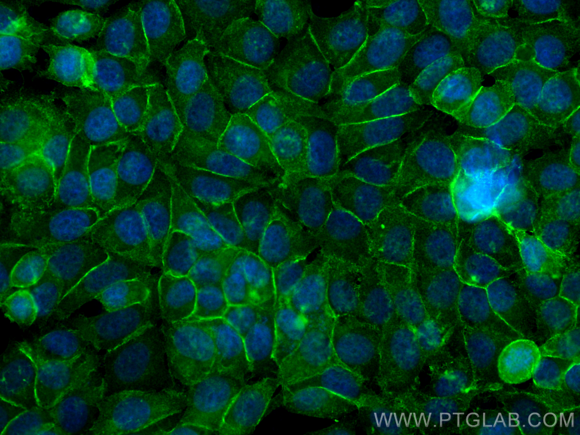 Immunofluorescence (IF) / fluorescent staining of MCF-7 cells using IQGAP1 Polyclonal antibody (22167-1-AP)