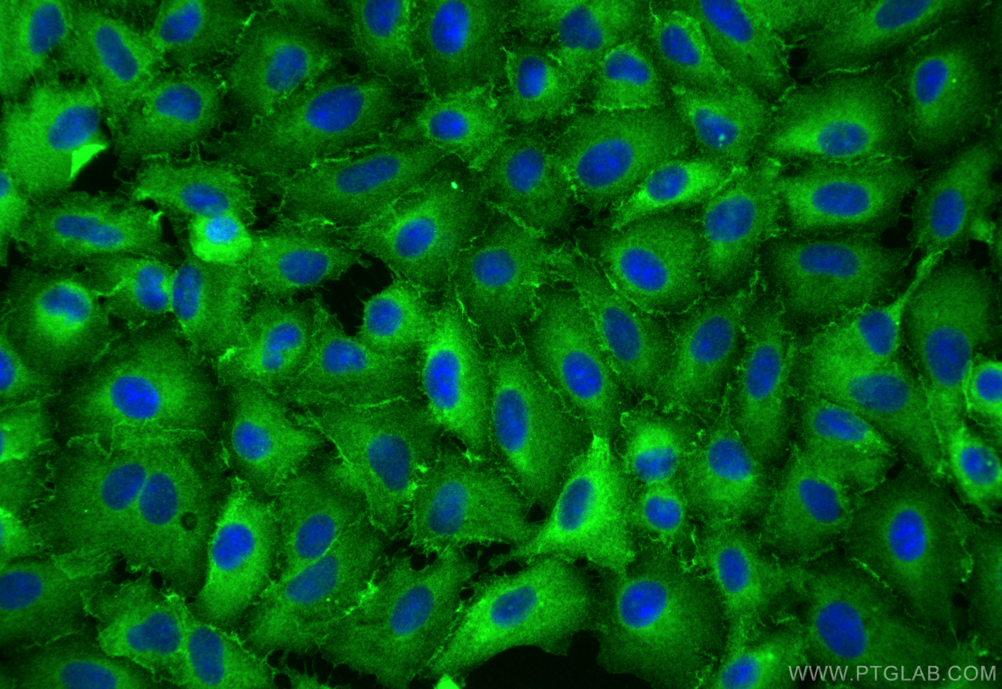 Immunofluorescence (IF) / fluorescent staining of A549 cells using IQGAP1 Polyclonal antibody (22167-1-AP)