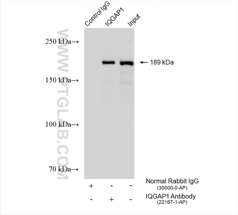 Immunoprecipitation (IP) experiment of HeLa cells using IQGAP1 Polyclonal antibody (22167-1-AP)