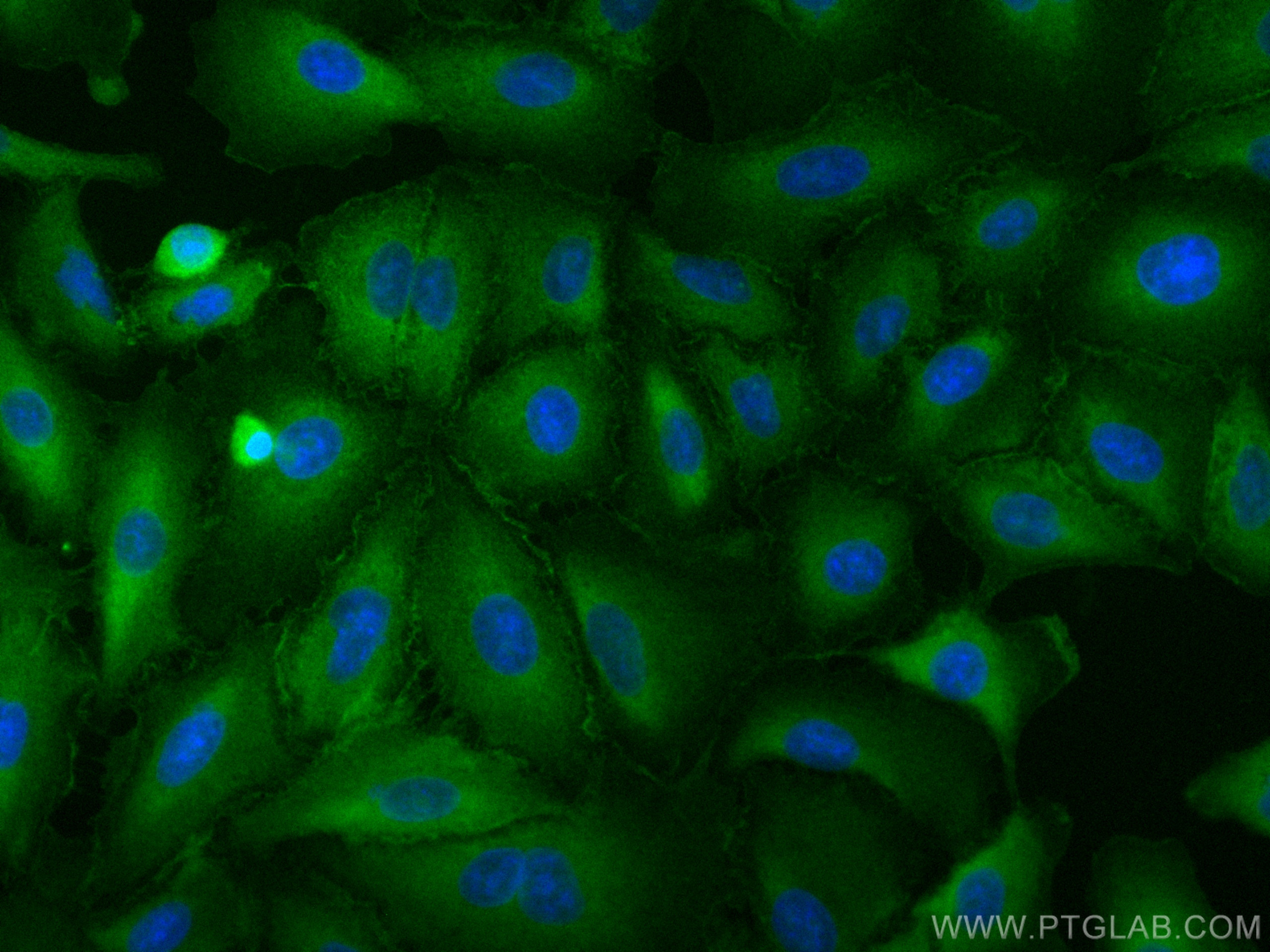 Immunofluorescence (IF) / fluorescent staining of A549 cells using CoraLite® Plus 488-conjugated IQGAP1 Polyclonal an (CL488-22167)