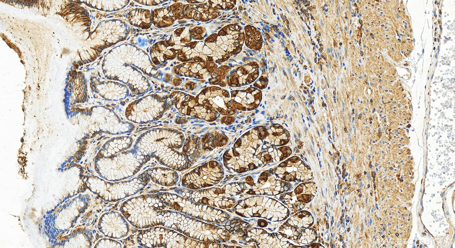 Immunohistochemistry (IHC) staining of human stomach tissue using IQGAP2 Polyclonal antibody (30692-1-AP)