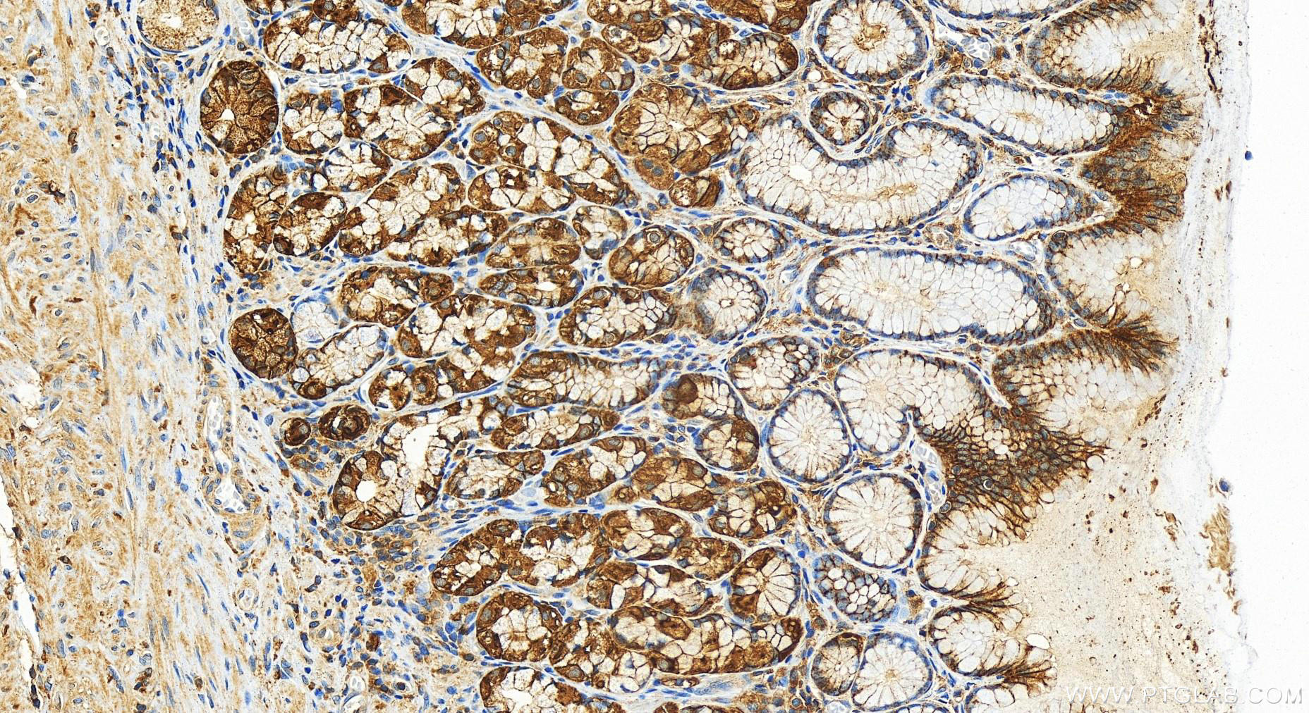 Immunohistochemistry (IHC) staining of human stomach tissue using IQGAP2 Polyclonal antibody (30692-1-AP)