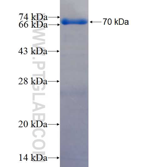 IQWD1 fusion protein Ag26630 SDS-PAGE