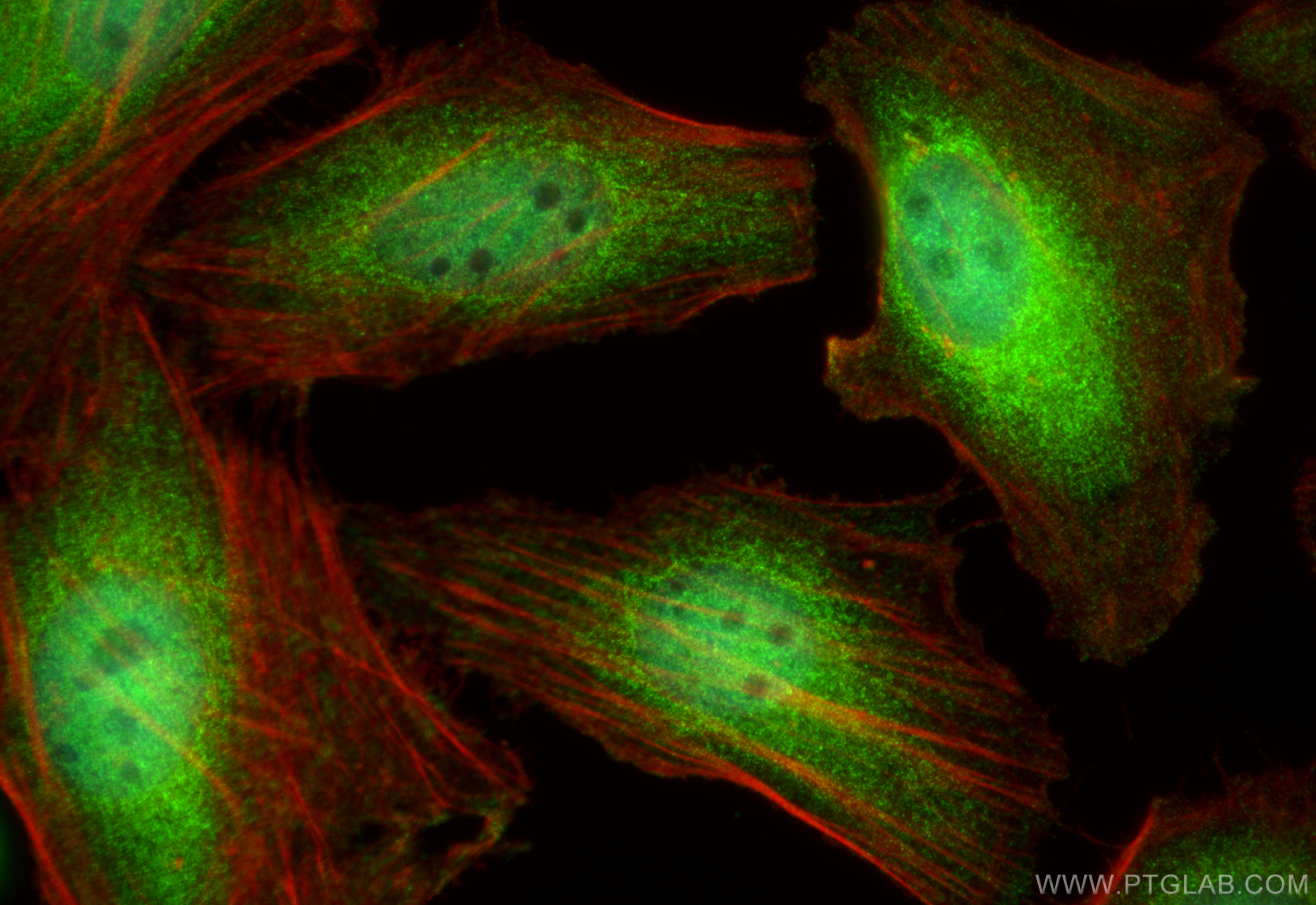 Immunofluorescence (IF) / fluorescent staining of HeLa cells using IRAK1 Polyclonal antibody (10478-2-AP)