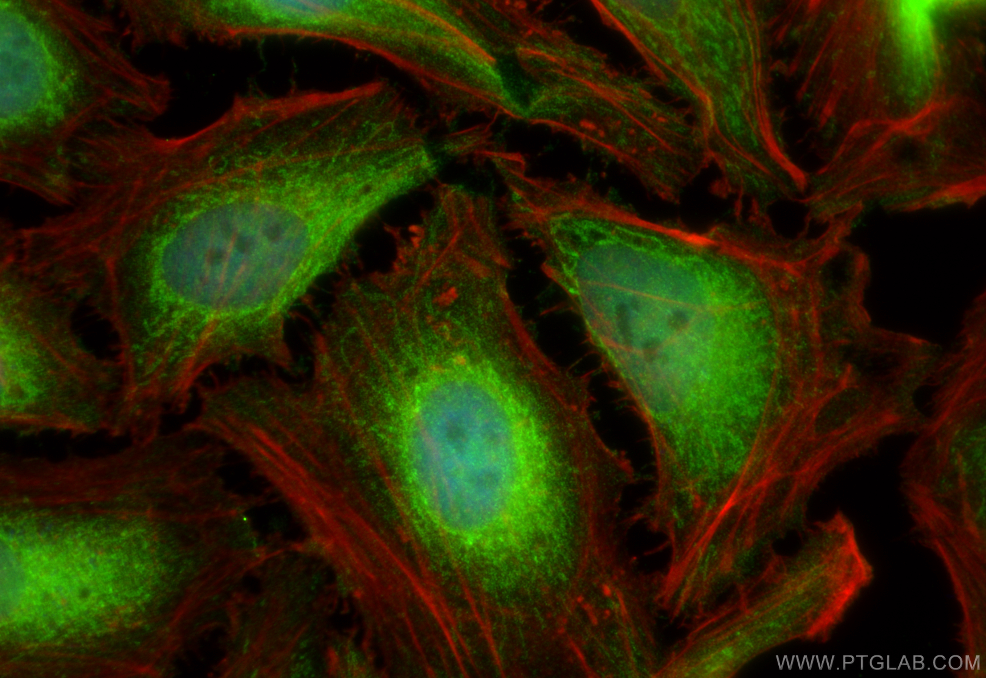 Immunofluorescence (IF) / fluorescent staining of HeLa cells using IRAK1 Polyclonal antibody (10478-2-AP)